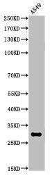 Acetyl-ATF5 (K29) Antibody