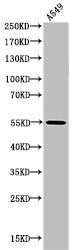 Acetyl-RELA (K218) Antibody