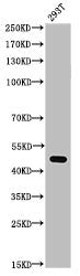 Acetyl-TP53 (K372) Antibody