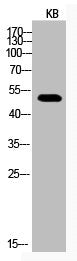 Acetyl-TP53 (K373) Antibody