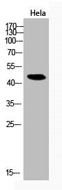 Acetyl-RELA (K314/K315) Antibody