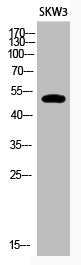 Acetyl-TP53 (K320) Antibody