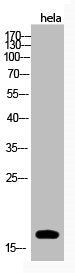 Acetyl-Histone H3 (K123) Antibody
