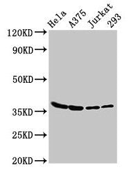 LDHA Antibody