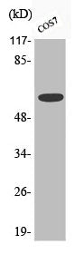Phospho-CHEK2 (S516) Antibody