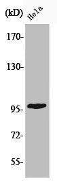 Phospho-CHEK2 (T68) Antibody