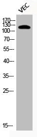 Phospho-HDAC5 (S498) Antibody