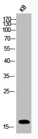 Phospho-Histone H3 (S10) Antibody