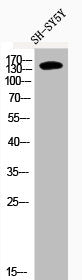 Phospho-IRS1 (S636) Antibody