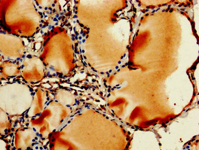 RPL11 Antibody