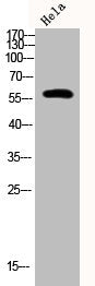 Phospho-PFKFB2 (S483) Antibody