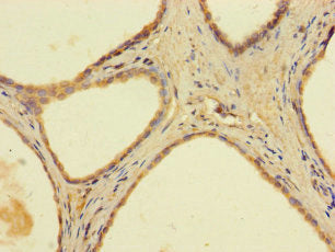 AADAC Antibody