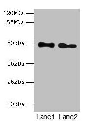 ABHD2 Antibody
