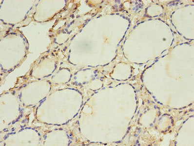 ACAA1 Antibody