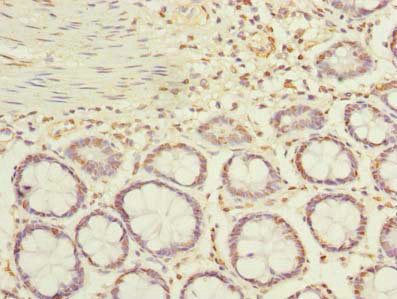 ACTRT1 Antibody