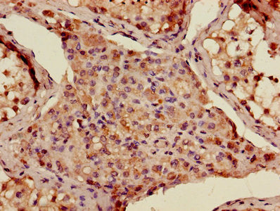 ADAMTS12 Antibody