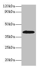 ADH1B Antibody