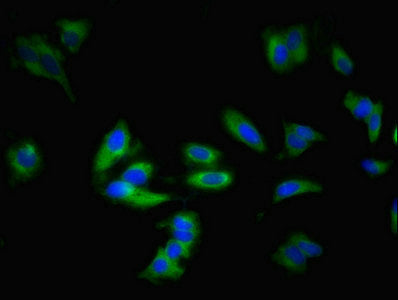 ADORA1 Antibody