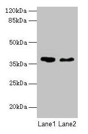 AGA Antibody