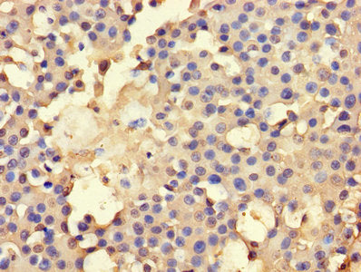 AHCY Antibody