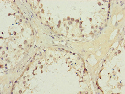 AKR1D1 Antibody