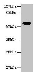 Aldh1a1 Antibody