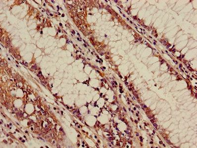 ALOX5 Antibody