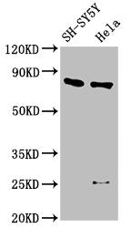 CTNNB1 Antibody