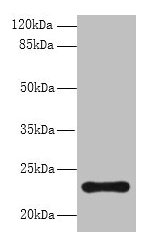 AP3S2 Antibody