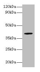 ARSB Antibody