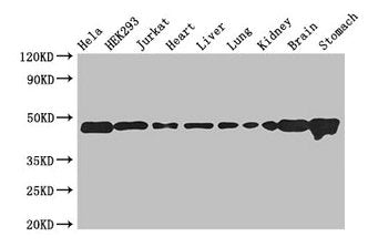 ASCC1 Antibody