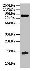 Hemoglobin Antibody