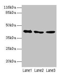 ATXN3 Antibody