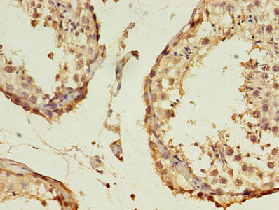 B3GNT5 Antibody