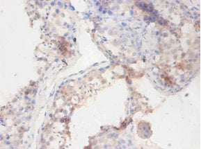 BCHE Antibody