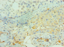 BIN1 Antibody