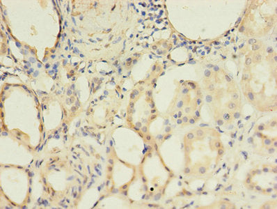 BMPR1A Antibody