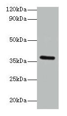 BRCC3 Antibody