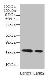 LGB Antibody