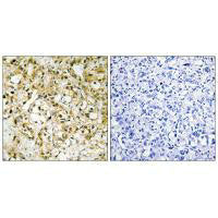 TFAM Antibody