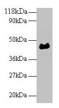 α1-acidglycoprotein Antibody