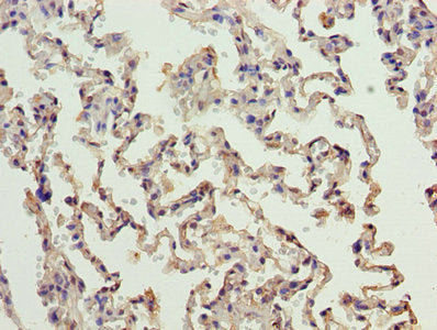 ERCC6L2 Antibody