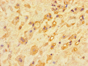 CA11 Antibody