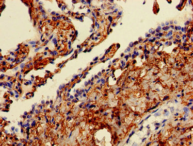 CAPZA2 Antibody
