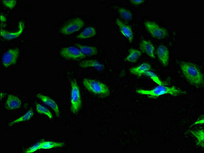 CASR Antibody