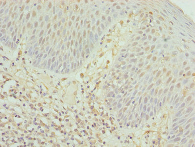 CD8A Antibody