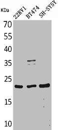 FGF12 Antibody