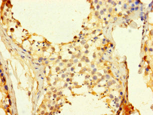 CDC25C Antibody