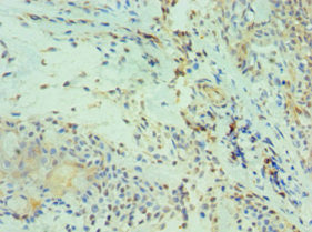 CDH13 Antibody
