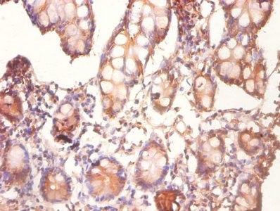 CDK2AP1 Antibody